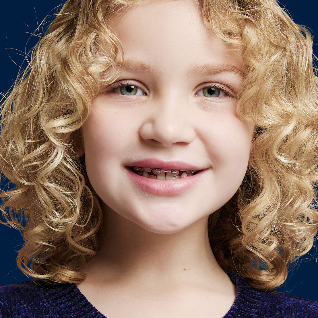 Free Early Orthodontic Monitoring for Kids in Alpharetta, GA | Awbrey Orthodontics